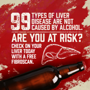 99 types of liver disease are not caused by alcohol. 