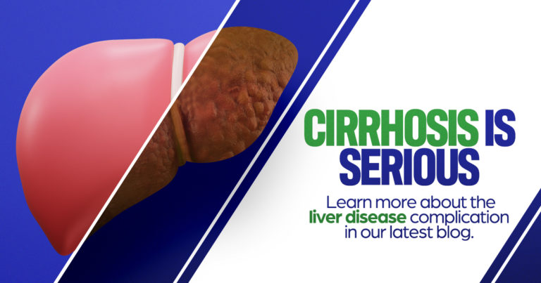 Cirrhosis is serious. Learn more about the liver disease complication in our latest blog.